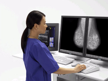 mammografia-badanie